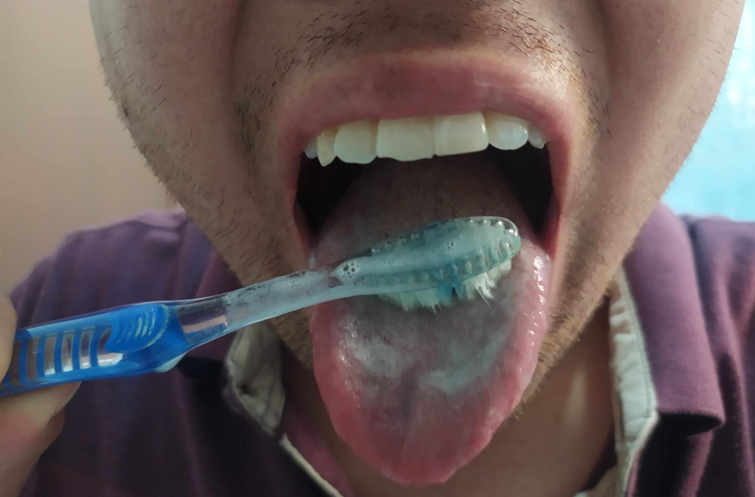 Cepillado de la lengua-hr-dental